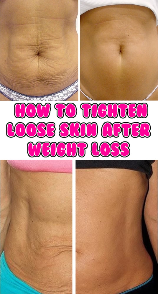 How-to-Tighten-Loose-Skin-After-Weight-Loss2