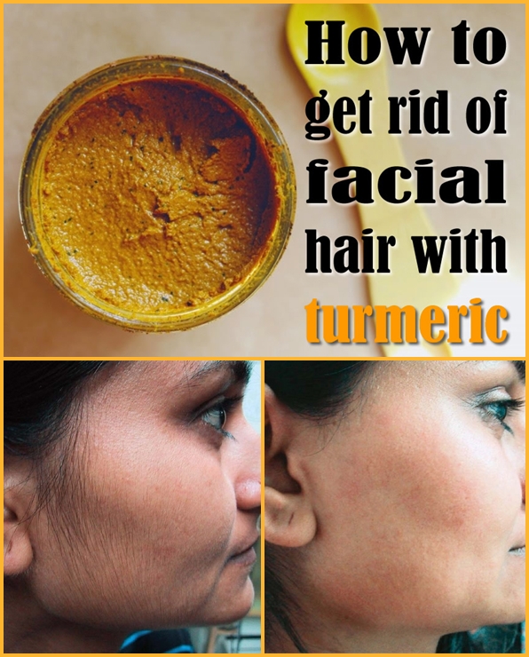 How-to-get-rid-of-facial-hair-with-turmeric-2