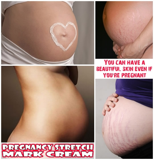 Pregnancy-Stretch-Mark-Cream